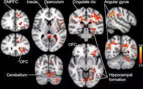 原来你也是一个良性受虐者